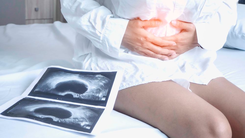 Ovarian Cyst Symptoms: How They Develop, How to Treat Them